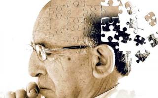 Симптомы болезни альцгеймера: как вовремя диагностировать недуг