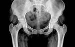 Рентген (рентгенография) костей таза: суть метода, подготовка