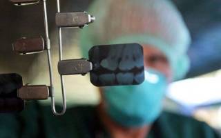 Рентген зуба: когда нужен и как делают