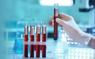 Анализ крови на сифилис: подготовка, расшифровка результатов