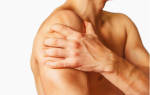 Операция при привычном вывихе плеча: виды вмешательства, реабилитация