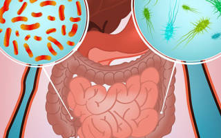 Причины возникновения желудочно-кишечных инфекций