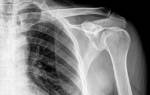 Рентген костей предплечья: показания, как проходит процедура