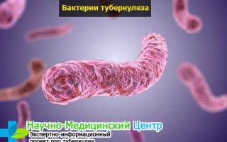Туберкулез: механизм развития и классификация болезни