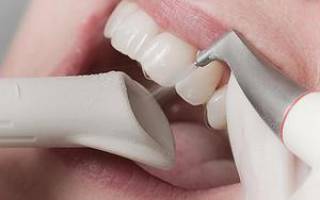 Ультразвуковая чистка зубов air flow: как проходит очищение