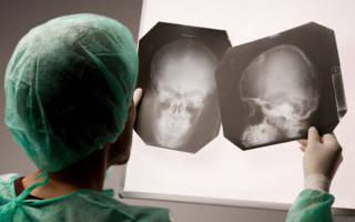 Рентген черепа: что показывает, подготовка к процедуре