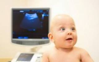 Узи головного мозга: показания для новорожденных и взрослых