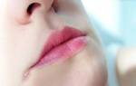 Трещины в уголках рта: причины, лечение