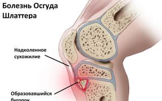 Рентген (рентгенография) коленного сустава: схема проведения