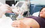 Узи органов малого таза у женщин: подготовка, расшифровка результатов