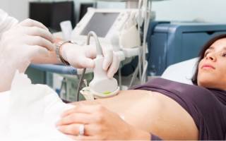 Узи органов малого таза у женщин: подготовка, расшифровка результатов