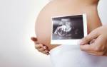 Узи в 3 триместре беременности: где и когда делают