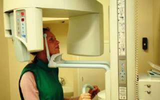 Рентген придаточных пазух носа: где сделать, что показывает
