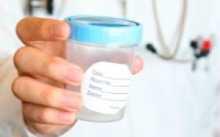 Биохимический анализ спермы: подготовка и схема проведения